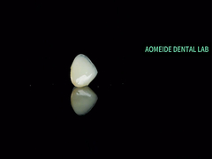 پل تاج سرامیکی