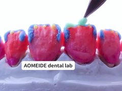 قدرت زیبایی طبیعی تاج زیرکونی جامد مناسب برای دندان های تک یا چندگانه