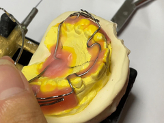 دستگاه ارتودنسی سفارشی ساخته شده با نگه داشتن خوب و ویژگی های تنظیم پذیر