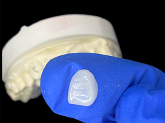 IPS e.max فنیرها برای برش در سایه A1 زیبایی طبیعی برای لبخند بی نقص