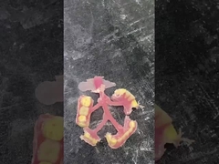 پروتز جزئی انعطاف پذیر نسبت برای راحتی و دوام در جایگزینی دندان