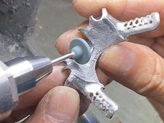 دندان مصنوعی پاره ای