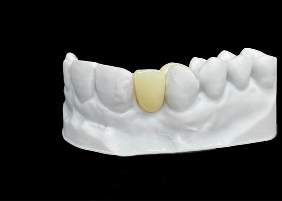 خرید مقاومت در برابر پاره شدن تاج دندان زرکونیا با قدرت استثنایی و شفافیت online manufacture