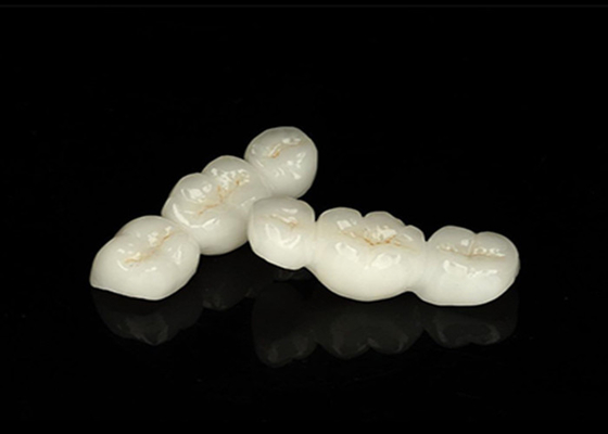 خرید تاج دندان زرکونیا شفاف و طبیعی با دوام عالی و تناسب دقیق online manufacture