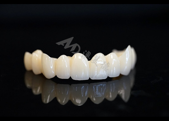 خرید تاج زيرکونيايي جامد با دقت ساخته شده براي تناسب و آسايش کامل دندان online manufacture