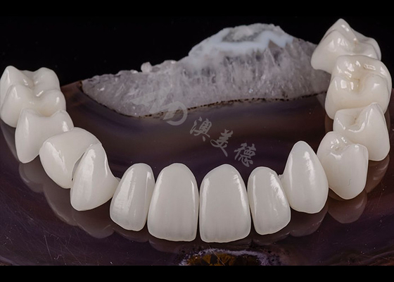 خرید دندان شفاف جامد تاج زیرکونیا زیبایی طبیعی مقاومت در برابر شکستگی online manufacture