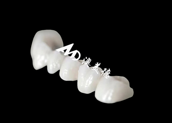 خرید تاج دندان زریکونیا با ظاهر طبیعی شگفت انگیز online manufacture