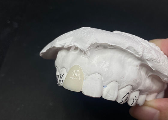 قیمت خوب پوشه های شفاف دندان های سفارشی راه حل های سریع و موثر برای لبخند طولانی مدت آنلاین