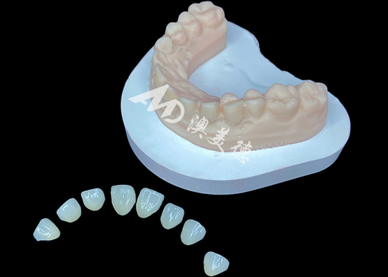 خرید IPS e.max Veneer راه حل زیبایی شناسی برتر برای تحولات لبخند خارق العاده online manufacture