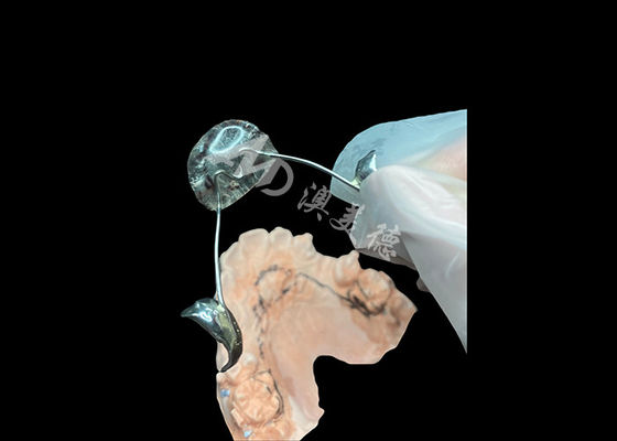 قیمت خوب دستگاه ارتودنسی نانس راه حل مطلوب ثبات فک و حفظ فضا آنلاین