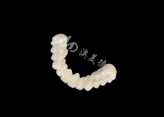 خرید بسته بندی طولانی مدت PFM پل تاج دندان با سازگاری بیولوژیکی عالی online manufacture