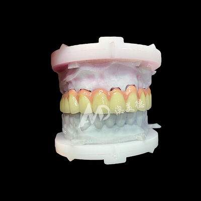 خرید تاج و پل سرامیکی تیتانیوم خالص online manufacture