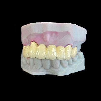 خرید روکش PFM (پرسلن ذوب شده به فلز) با چارچوب Co-Cr online manufacture