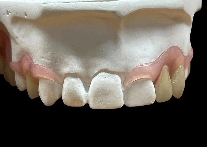 دندانهای مرسوم و انعطاف پذیر برای جویدن راحت و صحبت کردن
