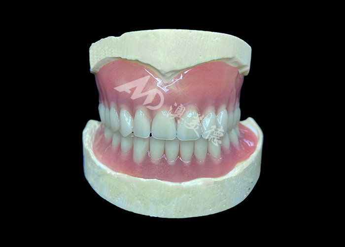 دندان های کاستی جزئی که تمیز کردن آنها آسان است برای بازیابی توانایی جویدن و لبخند مناسب است