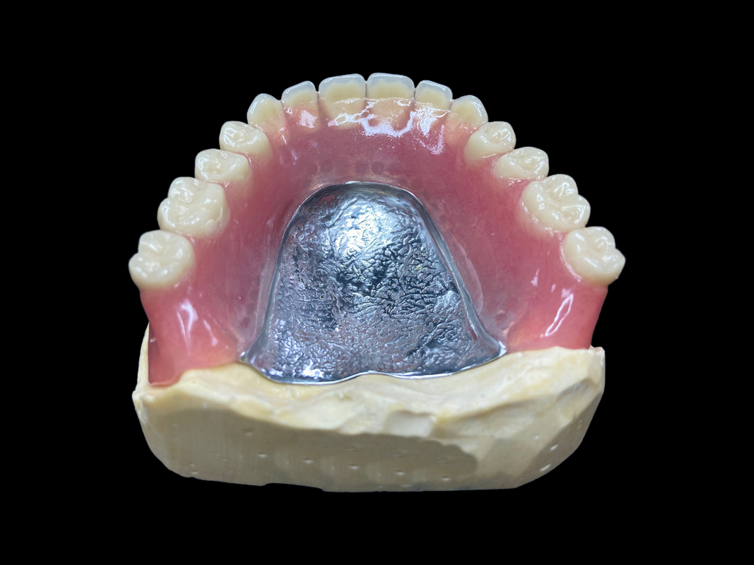 دندان های کاستی جزئی که تمیز کردن آنها آسان است برای بازیابی توانایی جویدن و لبخند مناسب است