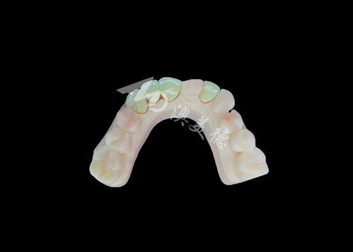 طبیعی و راحت مناسب زرکونیا تاج پورسلین چین لابراتوار دندانپزشکی سایه سفارشی
