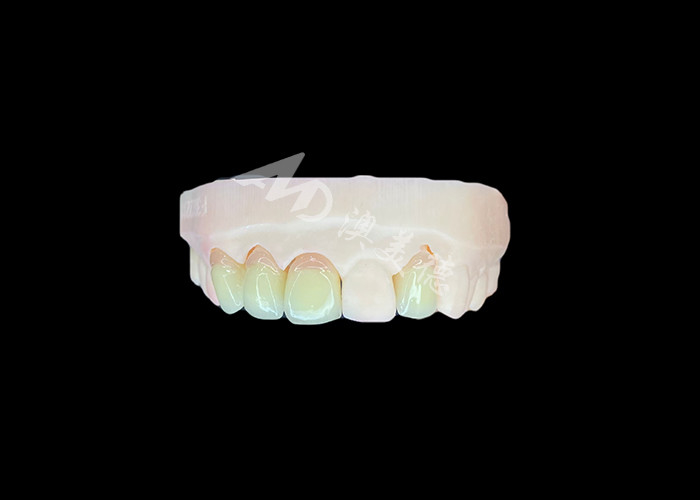 طبیعی و راحت مناسب زرکونیا تاج پورسلین چین لابراتوار دندانپزشکی سایه سفارشی