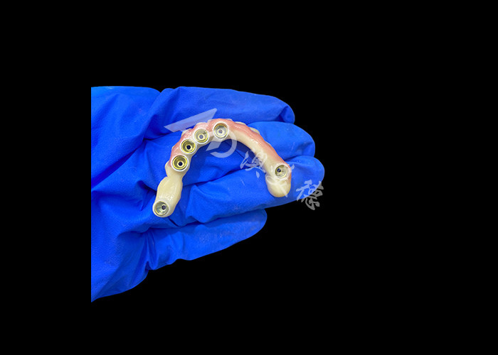 تیتانیوم Abutment و Zirconia تاج ایمپلنت پشتیبانی دندان های مصنوعی دقت مناسب برای پوشیدن راحت