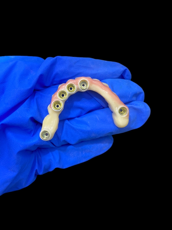 تیتانیوم Abutment و Zirconia تاج ایمپلنت پشتیبانی دندان های مصنوعی دقت مناسب برای پوشیدن راحت