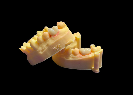 قیمت خوب تاج دندانی فرش زرکونیا درجه یک قدرت بی نظیر دقت تناسب و زیبایی شناسی استثنایی و دوام آنلاین