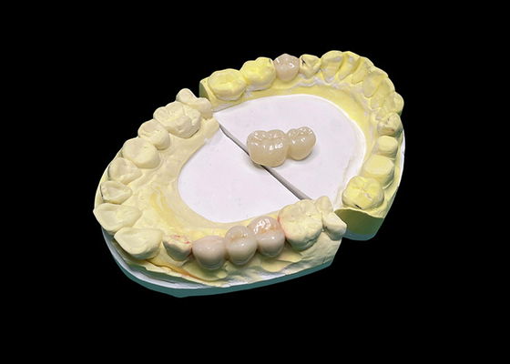 قیمت خوب تاج و پل های سرامیکی شفاف پیشرفته لبخند شما را با دقت و زیبایی طبیعی برای دوام طولانی افزایش می دهند آنلاین