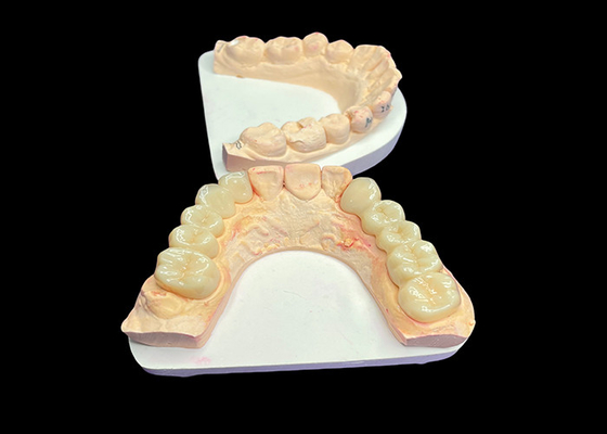 قیمت خوب زیبایی طبیعی تاج های سرامیکی شفاف برای بازسازی دندان با تمیز کردن آسان و نتایج طولانی مدت آنلاین