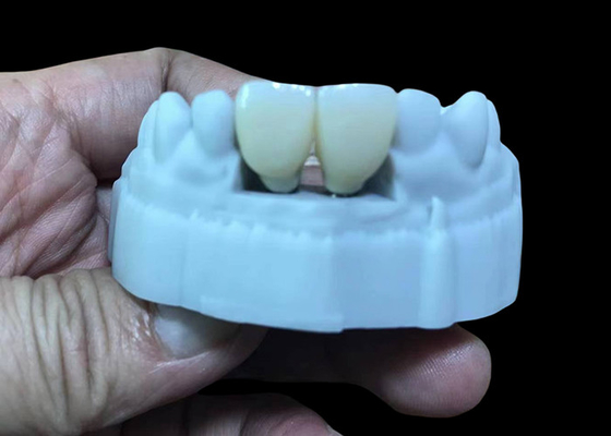قیمت خوب جايگزين تاج غلاف دندان با تيتانيوم و تاج زيركوني آنلاین