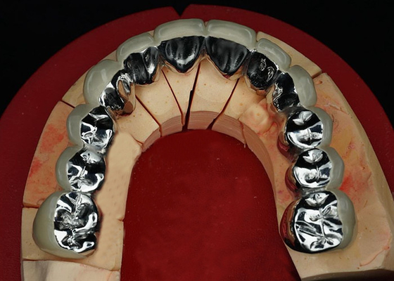 قیمت خوب پورسلین بسیار مقاوم که به تاج فلزی تبدیل شده است آنلاین