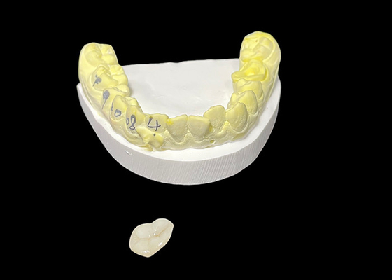 قیمت خوب تزریقات سرامیکی و تزریقات سرامیکی مخصوص دندان برای راه حل های ترمیم کننده و ترمیم دندان های آسیب دیده آنلاین
