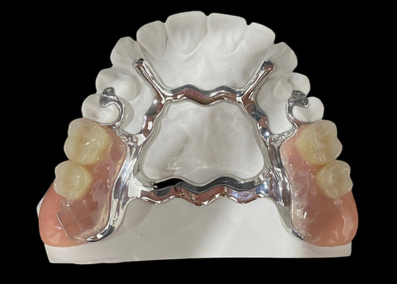 قیمت خوب دندان مصنوعی قابل برداشتن جزئی با پایه فلزی و رزین آکریلیک برای یک تناسب ایمن و ظاهر طبیعی آنلاین