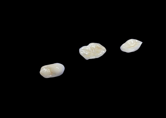 قیمت خوب تزئینات و تزئینات سرامیکی سازگار با زیست برای دوام راحت و ادغام بدون درز با دندان های طبیعی طراحی شده است آنلاین