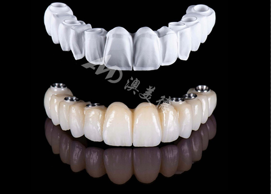 قیمت خوب مقرون به صرفه و دقیق تاج کامل زرکونیا ، تاج دندان زرکونیا با قدرت بالا آنلاین
