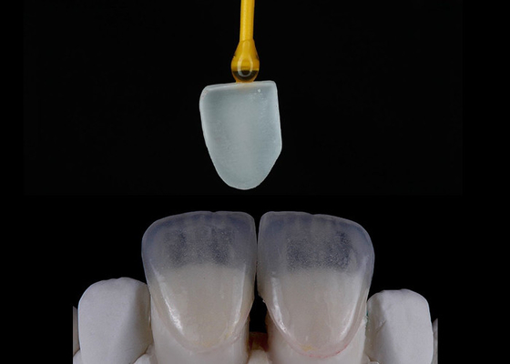 قیمت خوب بازسازی دندان های سفارشی EMAX Veneers به زیبایی تراز شده چاپ دیجیتال آنلاین