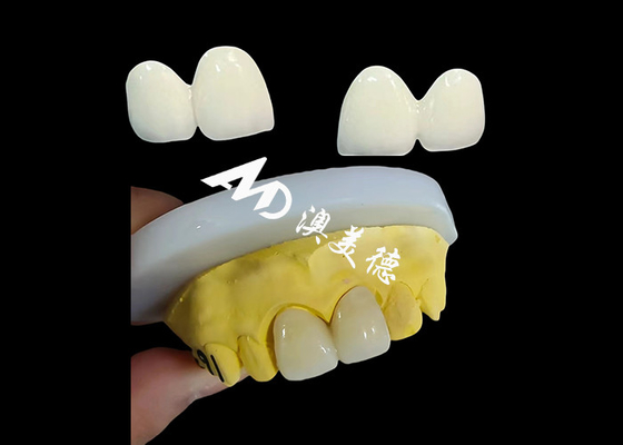 قیمت خوب تاج دندانی زرکونیا سفارشی از لابراتوار دندان چین آنلاین