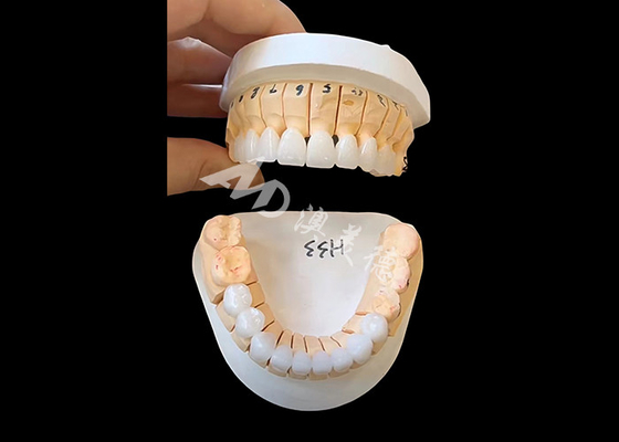 قیمت خوب تاج دندان زیرکونی با شفافیت افزایش یافته برای بازسازی های ثابت تک / چند واحد آنلاین