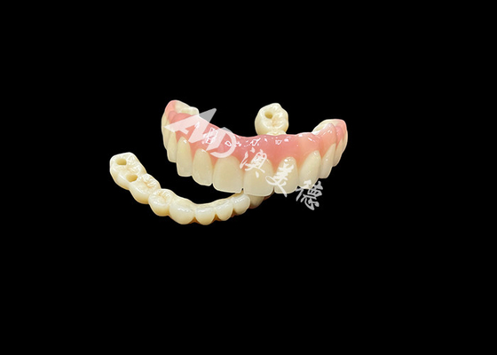 قیمت خوب پروتز های مستندی که از آن ها استفاده می شود، راه حل نهایی دندانپزشکی برای دندان های گمشده آنلاین