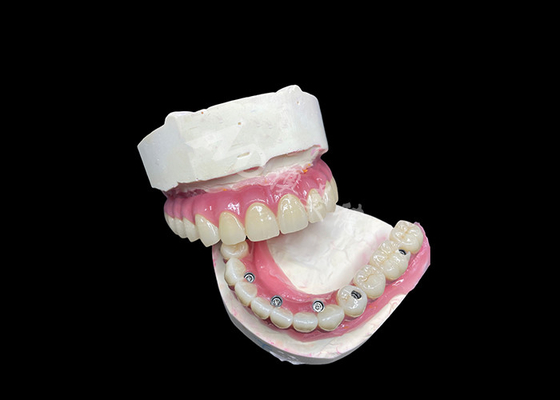 قیمت خوب کل پل تاج زيرکونيايي براي جایگزيني دندون هاي گمشده آنلاین