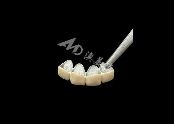 قیمت خوب پورسلن ذوب شده به تاج فلزی با مقاومت بیشتر در برابر خوردگی آنلاین