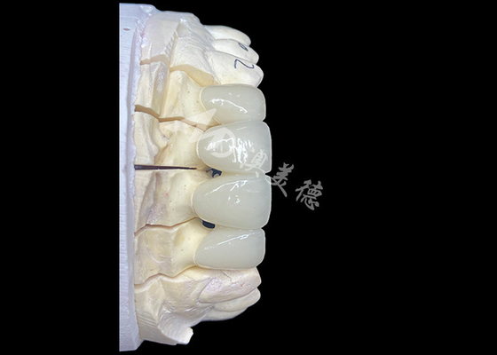 قیمت خوب پل تاج سرمیکی زرکونیا با ظاهر طبیعی، دقت و زیبایی را به همراه دارد آنلاین