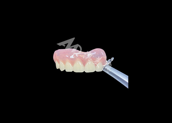 قیمت خوب پروتز پاره ای که به راحتی می شود درست کرد، توانایی جویدن و صحبت کردن را بهبود می بخشد آنلاین