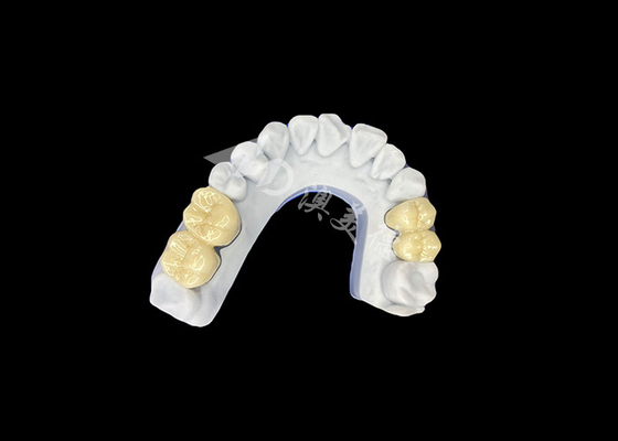 قیمت خوب تاج دندانی فرش زرکونیا PFZ از آزمایشگاه حرفه ای دندانپزشکی چین آنلاین