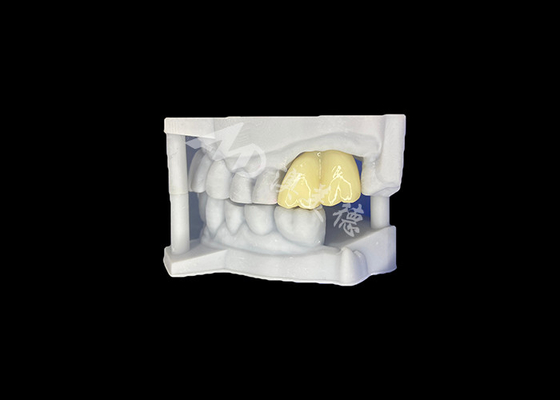 قیمت خوب تاج دندانی از زیرکونیای جامد دوام طولانی تضمین شده از آزمایشگاه دندانی چین آنلاین