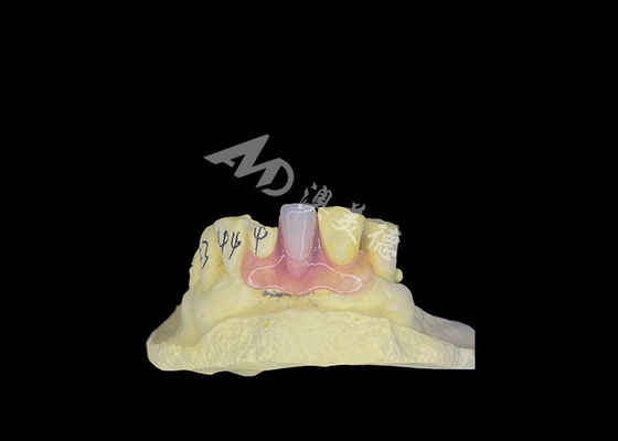 قیمت خوب پروتز جزئی انعطاف پذیر نسبت برای راحتی و دوام در جایگزینی دندان آنلاین