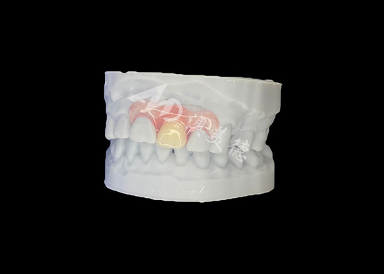 قیمت خوب دندانهاي انعطاف پذير نسبيت براي تناسب طبيعي و آسايش طولاني آنلاین