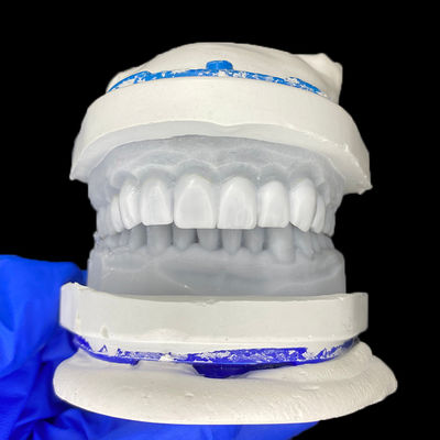 قیمت خوب Diagnostic Wax-Up for Porcelain Veneers آنلاین