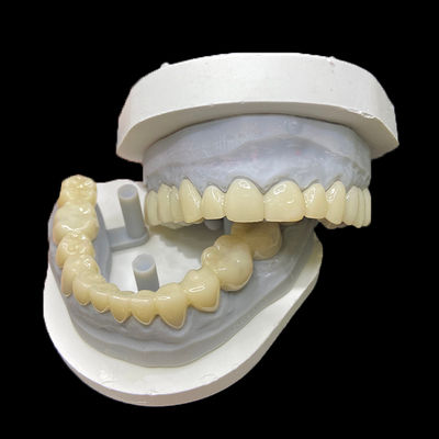 قیمت خوب PMMA Temporary Restorations CAD/CAM PMMA Crowns and Bridges for Provisional Dental Cases آنلاین