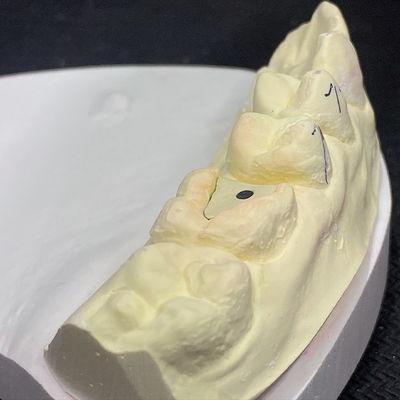 قیمت خوب بازسازی خود را با فناوری هسته پینکی پُست تقویت کنید آنلاین