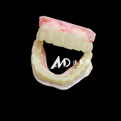 قیمت خوب Lightweight PMMA Temporary Bridges with Hollow Design for Implant Restorations آنلاین