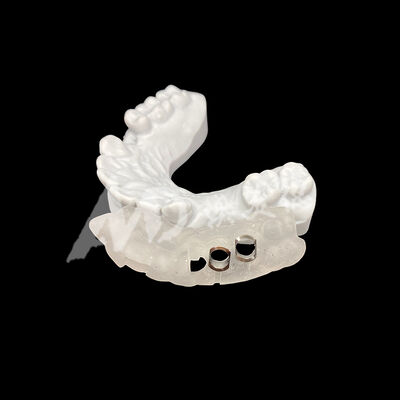 قیمت خوب راهنمای ایمپلنت جراحی چاپ شده سه بعدی با مقاومت بالا در برابر تغییر رنگ با استفاده از فناوری آسیاب CAD / CAM آنلاین